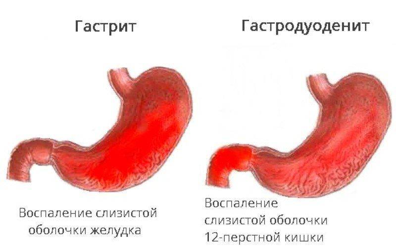 Слизистая оболочка 12 кишки